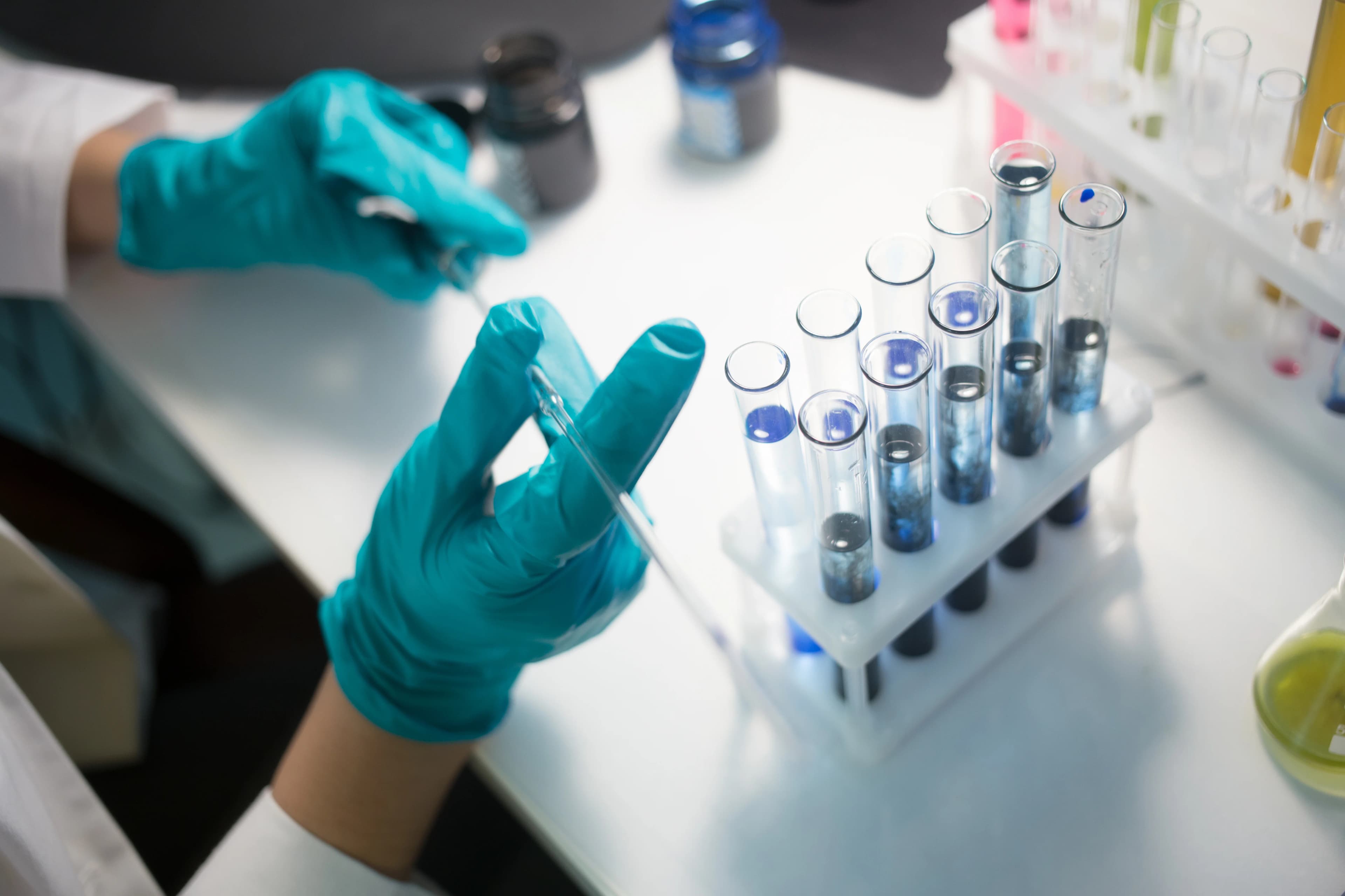 Carnitine and Acylcarnitine Testing